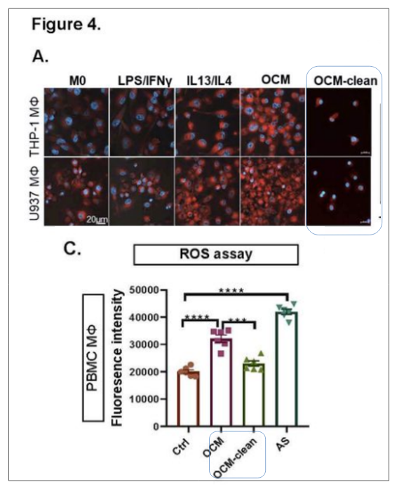Polyunsaturated Fatty Acids Promote Protumoral Macrophage Polarization via a RhoA-YAP1 Signaling Pathway in the Ovarian Cancer Microenvironment.